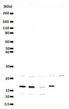 Anti-phospho (Ser10)-acetyl (Lys14)-Histone H3 Antibody Upstate&#174;, from rabbit