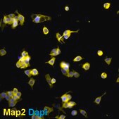 N2A Psen1/Psen2 Double Knockout Mouse Neuroblastoma Cell Line