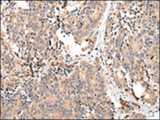 Anti-EPHA2 affinity isolated antibody