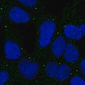 Anti-MFSD3 antibody produced in rabbit Prestige Antibodies® Powered by Atlas Antibodies, affinity isolated antibody, buffered aqueous glycerol solution