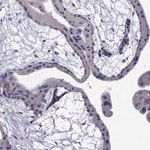 Anti-NME5 antibody produced in rabbit Prestige Antibodies&#174; Powered by Atlas Antibodies, affinity isolated antibody, buffered aqueous glycerol solution
