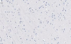 Anti-TPH-1 Antibody, clone 3J7 ZooMAb&#174; Rabbit Monoclonal recombinant, expressed in HEK 293 cells