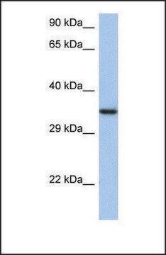 Anti-HORMAD2, (N-terminal) antibody produced in rabbit affinity isolated antibody