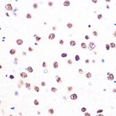 Anti-53BP1 Antibody, clone 8Y3Y4, Rabbit Monoclonal