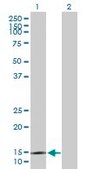 Anti-SYNJ2BP antibody produced in mouse IgG fraction of antiserum, buffered aqueous solution