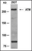 Anti-ATM (Ab-1981) antibody produced in rabbit affinity isolated antibody