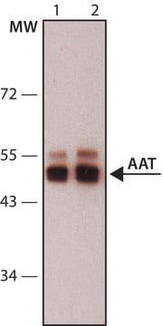 Anti-Alpha-1-Antitrypsin (AAT) antibody,Mouse monoclonal clone 1C2, purified from hybridoma cell culture