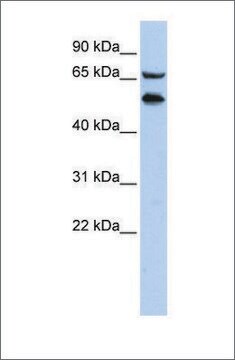 Anti-TADA2L (ab1) antibody produced in rabbit affinity isolated antibody