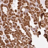 Anti-SDHA antibody produced in rabbit Prestige Antibodies&#174; Powered by Atlas Antibodies, affinity isolated antibody, buffered aqueous glycerol solution