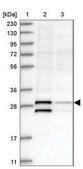 Anti-TRH antibody produced in rabbit Prestige Antibodies® Powered by Atlas Antibodies, affinity isolated antibody, buffered aqueous glycerol solution