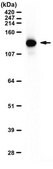 Anti-La-Related Protein 1 from rabbit, purified by affinity chromatography