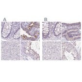 Anti-ANKRD45 antibody produced in rabbit Prestige Antibodies® Powered by Atlas Antibodies, affinity isolated antibody, buffered aqueous glycerol solution, ab2