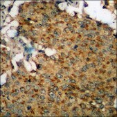 Anti-phospho-PKD1/2/3/PKC mu (pSer738+Ser742) antibody produced in rabbit affinity isolated antibody