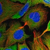 Anti-ST13 antibody produced in rabbit Prestige Antibodies&#174; Powered by Atlas Antibodies, affinity isolated antibody, buffered aqueous glycerol solution