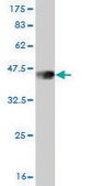 ANTI-OTX1 antibody produced in mouse clone 3A5, purified immunoglobulin, buffered aqueous solution