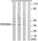 Anti-OR52B2 antibody produced in rabbit affinity isolated antibody