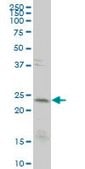 Monoclonal Anti-CD3E antibody produced in mouse clone 4C1, purified immunoglobulin, buffered aqueous solution