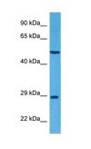 Anti-CLRN1 antibody produced in rabbit affinity isolated antibody