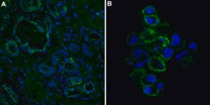 Anti-Epithelial Cell Adhesion Molecule (EpCAM) Antibody, clone 8 clone mab 8, from mouse