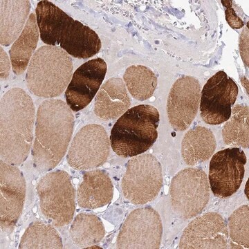 Anti-CXorf65 antibody produced in rabbit Prestige Antibodies&#174; Powered by Atlas Antibodies, affinity isolated antibody, buffered aqueous glycerol solution