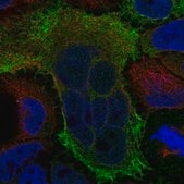 Anti-MOCS1 antibody produced in rabbit Prestige Antibodies&#174; Powered by Atlas Antibodies, affinity isolated antibody, buffered aqueous glycerol solution