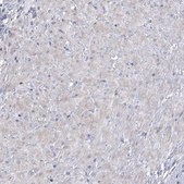 Anti-CES4A antibody produced in rabbit Prestige Antibodies&#174; Powered by Atlas Antibodies, affinity isolated antibody, buffered aqueous glycerol solution