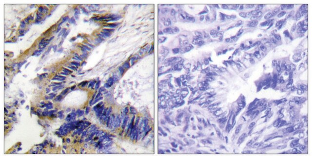 Anti-ILKAP antibody produced in rabbit affinity isolated antibody