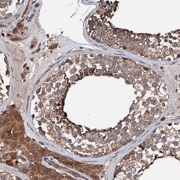 Anti-FGD4 antibody produced in rabbit Prestige Antibodies&#174; Powered by Atlas Antibodies, affinity isolated antibody, buffered aqueous glycerol solution
