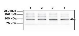 Anti-KIAA1549 antibody produced in rabbit affinity isolated antibody