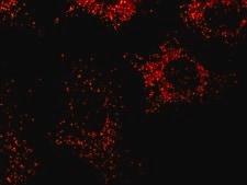 Anti-PMP70 antibody, Mouse monoclonal clone 70-18, purified from hybridoma cell culture