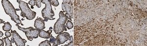 Anti-MMP-11 (Stromelysin-3) Antibody, clone 5ST-4A9 clone 5ST-4A9, from mouse