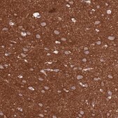 Anti-ANK2 antibody produced in rabbit Prestige Antibodies&#174; Powered by Atlas Antibodies, affinity isolated antibody, buffered aqueous glycerol solution