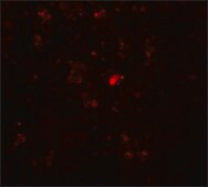 Anti-RBBP8 antibody produced in rabbit affinity isolated antibody, buffered aqueous solution