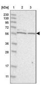 Anti-THEMIS2 antibody produced in rabbit Prestige Antibodies&#174; Powered by Atlas Antibodies, affinity isolated antibody, buffered aqueous glycerol solution, ab1
