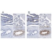 Anti-DNAI1 antibody produced in rabbit Prestige Antibodies® Powered by Atlas Antibodies, affinity isolated antibody, buffered aqueous glycerol solution, Ab2