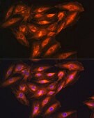 Anti- PHGDH antibody produced in rabbit