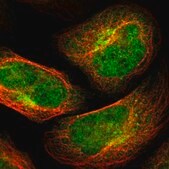 Anti-TSPAN9 antibody produced in rabbit Prestige Antibodies® Powered by Atlas Antibodies, affinity isolated antibody, buffered aqueous glycerol solution