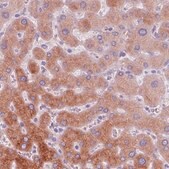 Monoclonal Anti-ACSL5 antibody produced in mouse Prestige Antibodies&#174; Powered by Atlas Antibodies, clone CL0275, purified immunoglobulin, buffered aqueous glycerol solution