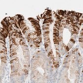Anti-KRT20 antibody produced in rabbit Prestige Antibodies&#174; Powered by Atlas Antibodies, affinity isolated antibody, buffered aqueous glycerol solution, Ab1