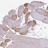 Anti-NUDT8 antibody produced in rabbit Prestige Antibodies&#174; Powered by Atlas Antibodies, affinity isolated antibody, buffered aqueous glycerol solution
