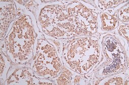Anti-phospho-ERBB2 (Y1139) antibody, clone 10G9, Rabbit Monoclonal recombinant, expressed in HEK293F cells