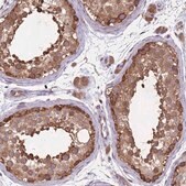 Anti-ARL13B antibody produced in rabbit Prestige Antibodies&#174; Powered by Atlas Antibodies, affinity isolated antibody, buffered aqueous glycerol solution