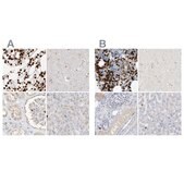 Anti-GCA antibody produced in rabbit Prestige Antibodies&#174; Powered by Atlas Antibodies, affinity isolated antibody, buffered aqueous glycerol solution