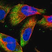 Anti-DCP1B antibody produced in rabbit Prestige Antibodies&#174; Powered by Atlas Antibodies, affinity isolated antibody, buffered aqueous glycerol solution