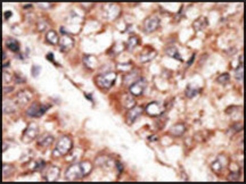 Anti-BMP15 (center) antibody produced in rabbit saturated ammonium sulfate (SAS) precipitated, buffered aqueous solution