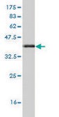 Monoclonal Anti-FZD3 antibody produced in mouse clone 2H5, purified immunoglobulin, buffered aqueous solution