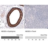 Monoclonal Anti-ABCB5 antibody produced in mouse Prestige Antibodies® Powered by Atlas Antibodies, clone CL13618, purified antibody (Protein A)