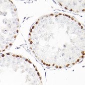 Anti-WT1 Antibody, clone 6L9X6, Rabbit Monoclonal