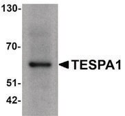 Anti-TESPA1 antibody produced in rabbit affinity isolated antibody
