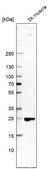 Anti-FITM1 antibody produced in rabbit Prestige Antibodies® Powered by Atlas Antibodies, affinity isolated antibody, buffered aqueous glycerol solution